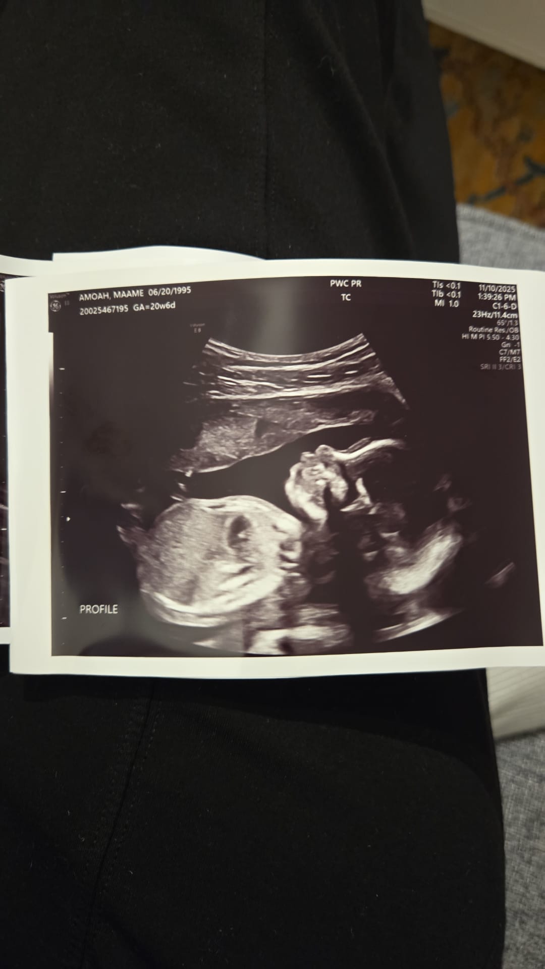 Ultrasound image of our first child